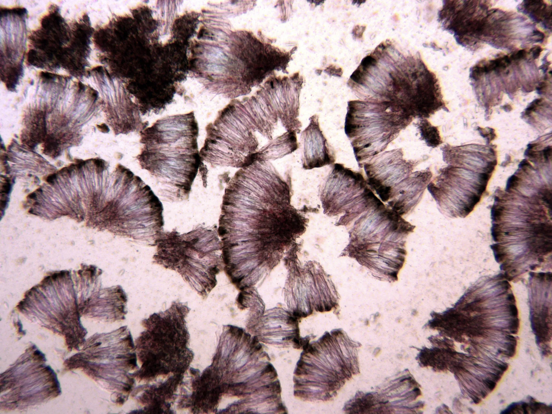 Microscopía de Psora decipiens - 10 - Bola negra x 100